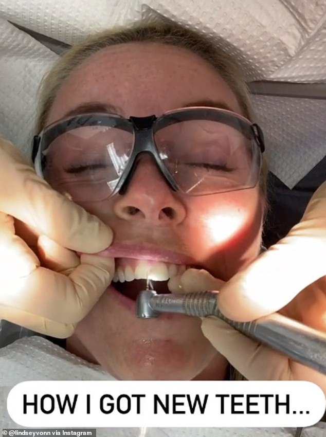 The process: a video of creatures with cosmetic dentist Dr. Bill Dorfman as she digs her teeth
