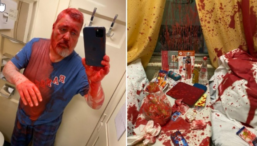 Russian Nobel laureate soaked in paint.  This is for our children.