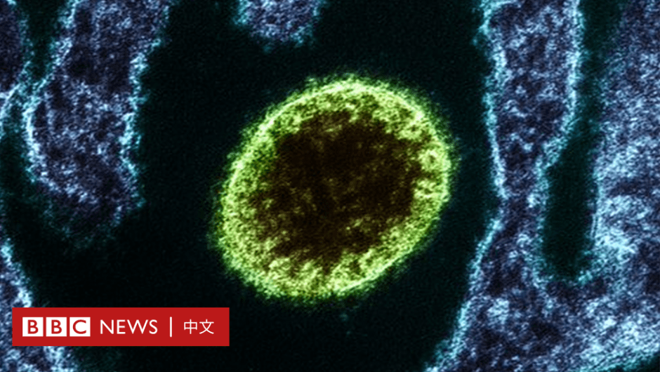 Langia Virus: What is this virus recently discovered in China?  – BBC News